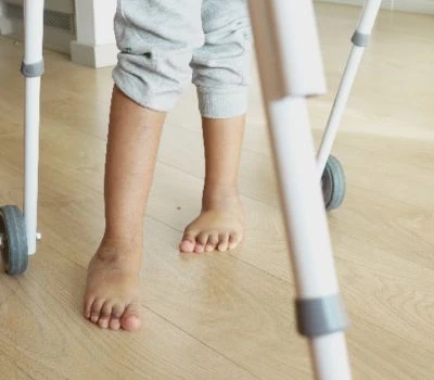 Discrepancia en la longitud de las piernas: comprender el desequilibrio, reconocer el daño y enco...