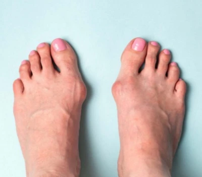 La epidemia silenciosa: los problemas de los pies en los niños son más comunes de lo que cree