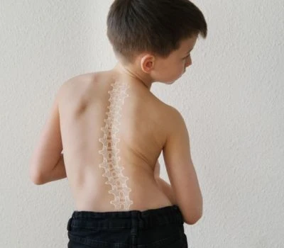 ¿El tiempo frente a la pantalla está remodelando la columna vertebral de una generación?