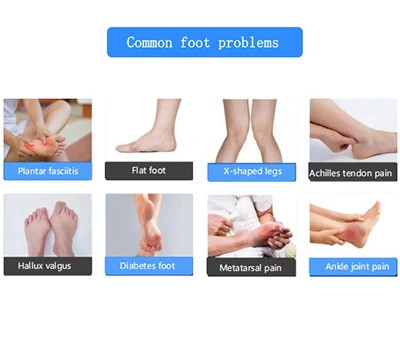 Revolucionando el cuidado de los pies: el escáner 3D de pies de Xianku transforma la ortopedia y ...