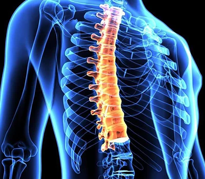 Corrección espinal: cómo el escáner del cuerpo Xianku3D está transformando la atención médica esp...